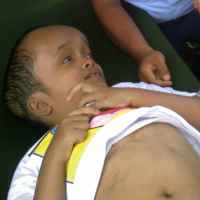 Sejak 1,5 Bulan, Dhani Menderita Hydrocepalus