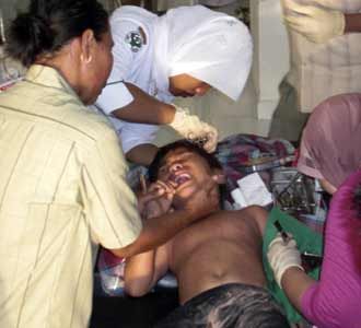 Korban Luka Gempa Aceh