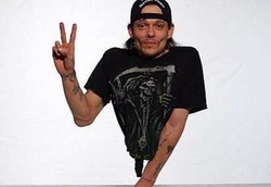 Manusia Setengah Tubuh Akibat Agenesis Sakral