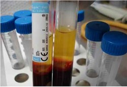 Doping Darah Dilarang, Atlet Pilih Terapi Plasma Darah