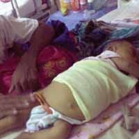 Lagi, Balita 7 Bulan di Surabaya Alami Atresia Billier