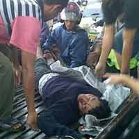 Disenggol Mobil, Biker Alami Luka Parah