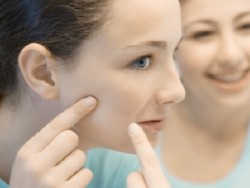 Alasan-alasan Untuk Tidak Memencet Jerawat Sendiri