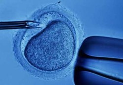 Klinik Yasmin RSCM Tak Mau Kalah dengan Asing