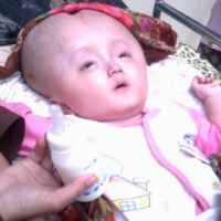 Jeritan Ridho, Bayi Malang Penderita Hydrocepalus