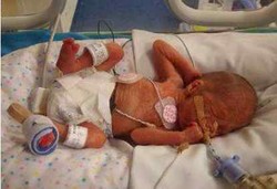 Bayi 4 Bulan Lahir Sempurna di Toilet