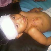 Warga Marah, Pemilik Anjing Akhirnya Tanggung Pengobatan Korban