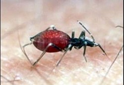 Infeksi Parasit yang Bisa Memicu Stroke