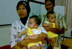 Lulu dan Lala Kini Tak Dempet Lagi