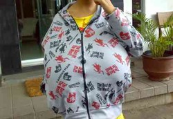 Nia Tak Berdaya dengan Payudara yang Membengkak Hebat