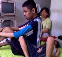 Terserang Lumpuh Sejak Balita