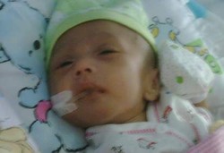 Usus Masih Terburai, Bintang Sudah Punya Anus Buatan