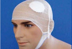 Geger Otak dan Hilang Ingatan