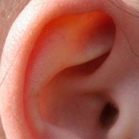 Hari Sadar Bising Sedunia, Tutup Telingamu Selama 60 Detik!