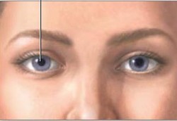 Bila Ukuran Pupil Mata Tidak Sama