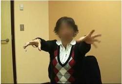 Gangguan Gerakan Bercermin yang Aneh