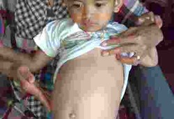 Bocah Elo Pipis dengan Gumpalan Darah