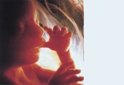 Kondisi Ibu Hamil di Trimester Kedua (2)