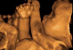 Kondisi Ibu Hamil di Trimester Ketiga (3)