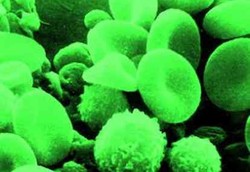 Saat Darah Manusia Berwarna Hijau