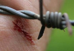 Luka yang Membawa Tetanus