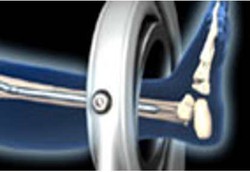 Magnet yang Membuat Badan Lebih Tinggi