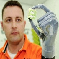 Tangan Bionik Bisa Mencengkeram dan Berdenyut 