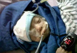 Usus Terburai Bintang Sudah Dimasukkan ke Tubuhnya