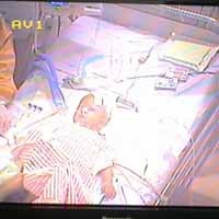 Dokter Temukan Sumber Pendarahan di Pencernaan Ramdan