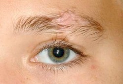 10 Penyakit Aneh yang Dialami Manusia