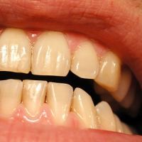 Kesal pada Game, Pria Gigit Ibu 