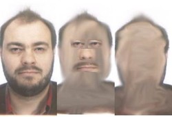 Buta Wajah yang Tak Bisa Melihat Bentuk Muka