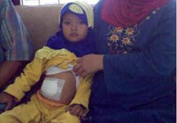 Kapan Operasi Kolostomi Perlu Dilakukan?