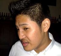 Hidung Adik Marcella Zalianty Patah