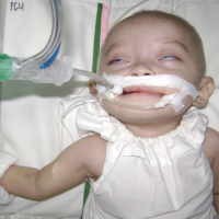 Lepas Ventilator, Tubuh Davina Membiru