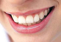 Gigi Sehat dengan 9 Langkah