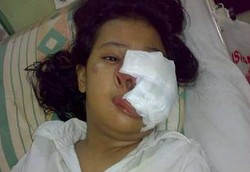 Wajah Diserang Tumor Ganas, Desi Tak Bisa Ikut UN