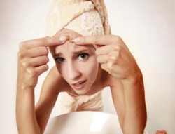 Hilangkan Jerawat dengan Bahan Alami