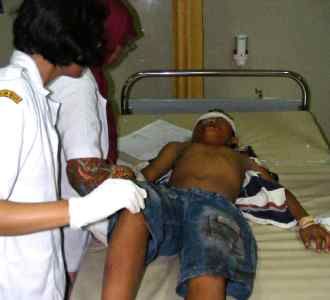 Korban Luka Bus Manis Masuk Jurang