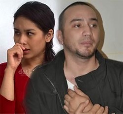 Gary Iskak Ngaku Gegar Otak Ringan Karena Risma