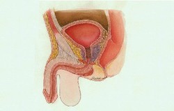 Benign Prostatic Hyperplasia (BPH)