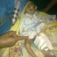 Belum Sempat Dioperasi, Nur Hadis Meninggal di RS Imanuel