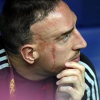 Seandainya Ribery Bisa Tampil