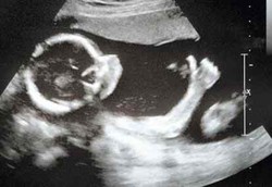 Bayi Beri Tanda Oke Saat USG