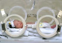 Risiko Penyakit Pada Bayi Lahir Prematur