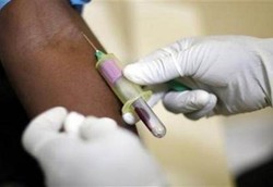 Cara Baru Pencegahan HIV