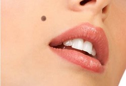 Banyak Tahi Lalat Memperlambat Penuaan 