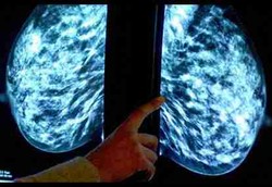 Vaksin Pencegah Kanker Payudara Segera Muncul