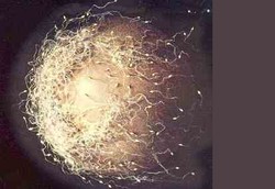 Memilih Bibit Unggul di Antara Jutaan Sperma