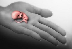 Imbalan Dana Rp 50 Juta untuk Perempuan yang Tidak Aborsi 